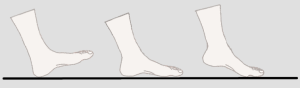 heel, midfoot, forefoot